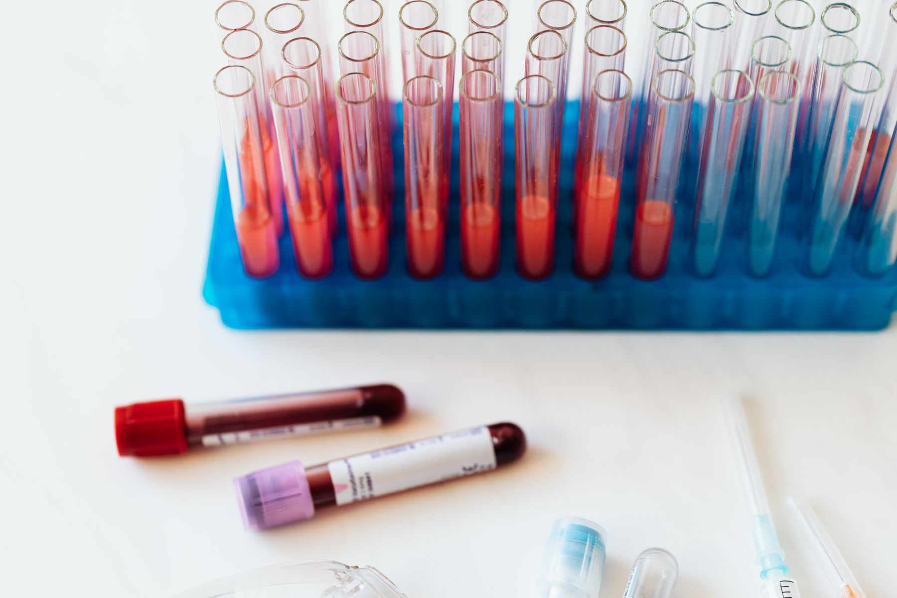 Blood sample test tubes arranged for laboratory testing